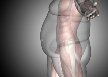 Exploring Weight Loss Surgery Options: A Comprehensive Guide