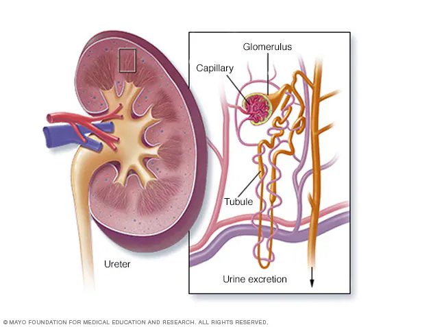 Acute kidney injury