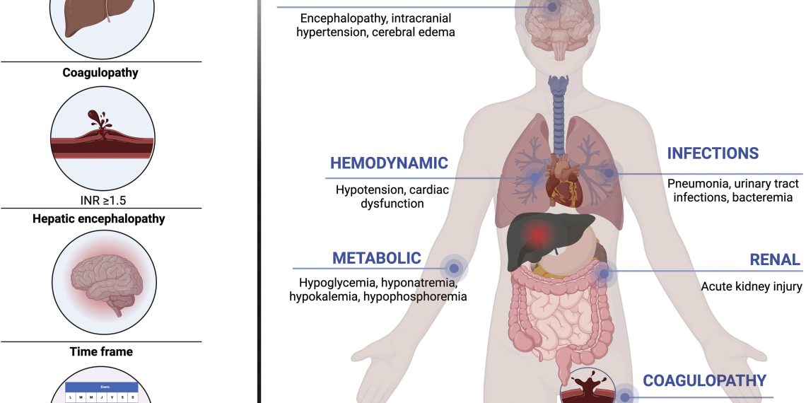 Acute liver failure