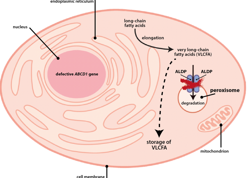 Adrenoleukodystrophy