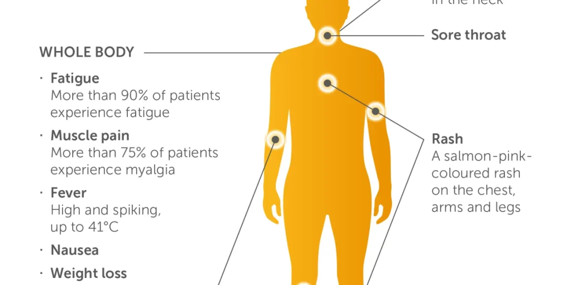 Adult Still Disease