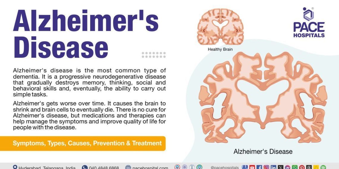 Alzheimer's disease