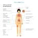 Anaphylaxis