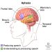 Aphasia