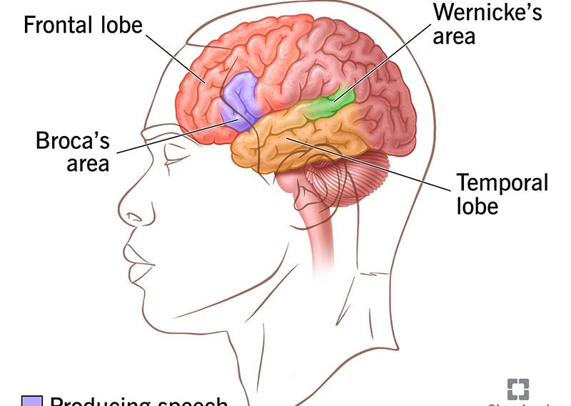Aphasia