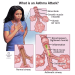 Asthma attack