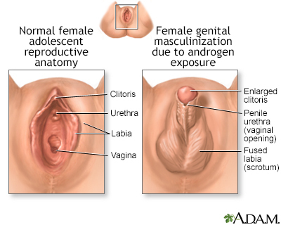 Atypical Genitalia