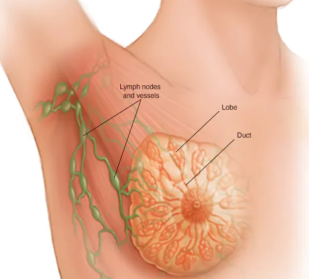 Atypical Hyperplasia of the Breast