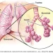 The bronchioles are some of the smallest airways in the lungs. Inhaled air passes through tiny ducts from the bronchioles into elastic air sacs (alveoli). The alveoli are surrounded by the alveolar-capillary membrane, which typically prevents liquid in the capillaries from entering the air sacs.