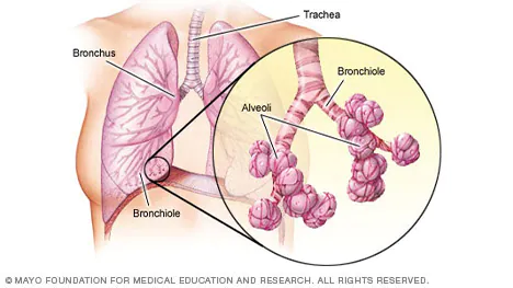 The bronchioles are some of the smallest airways in the lungs. Inhaled air passes through tiny ducts from the bronchioles into elastic air sacs (alveoli). The alveoli are surrounded by the alveolar-capillary membrane, which typically prevents liquid in the capillaries from entering the air sacs.