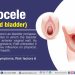 Anterior vaginal prolapse (cystocele)