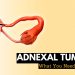 Understanding Adnexal Tumors