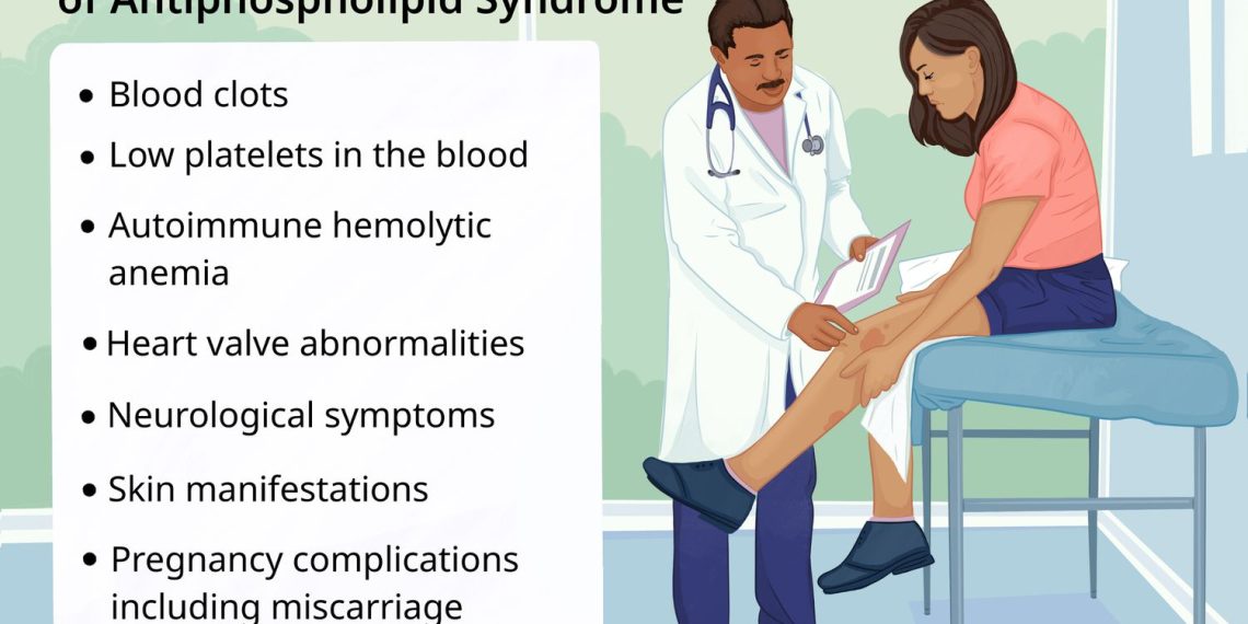Symptoms, Causes, and Management