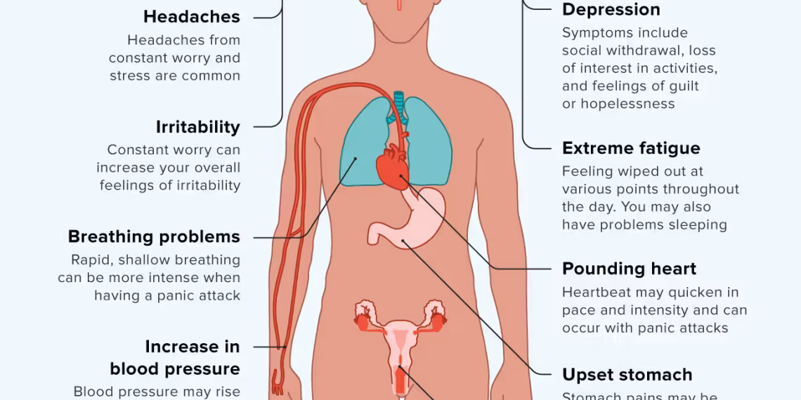 Anxiety Disorders