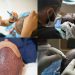 Hair Transplants in Kenya