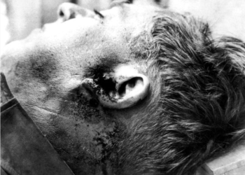 The lifeless body of Lord Eroll at City Mortuary showing a gunshot wound near the left ear after his 1941 murder.