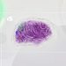 Hallucinations Happen When the Brain Fills in the Blanks