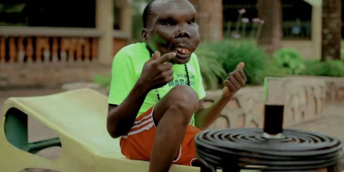 People Recognized by Guinness for Unique Physical Traits