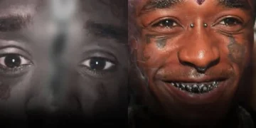 Lil Uzi Vert Diamond Implant Story